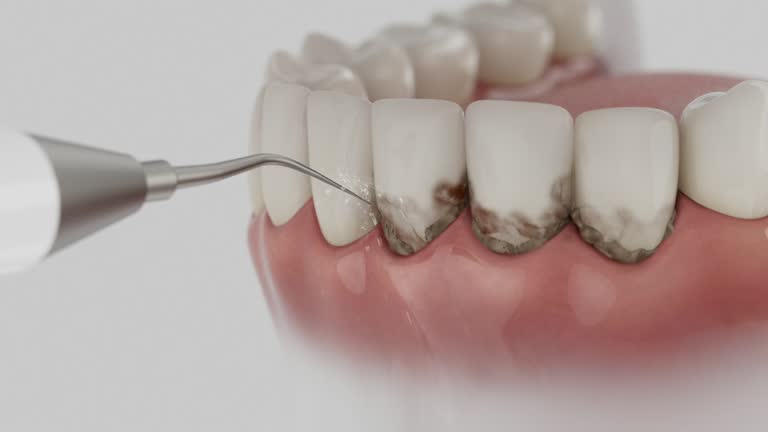 Trusted Dental Implants service in Lake Mack-Forest Hills, FL - Dentist Open Now